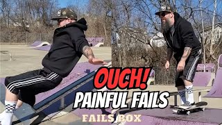 Broken Bones amp PAINFUL Fails  Fails Compilation [upl. by Ariad]