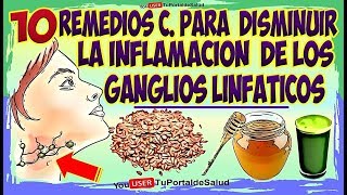 10 Remedios para Disminuir Inflamación de Ganglios Linfáticos Remedios Caseros Ganglios Linfaticos [upl. by Ettennig52]