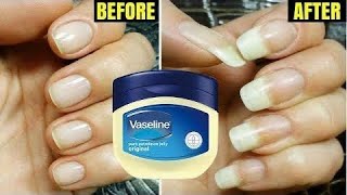 Méthode simple et efficace pour faire blanchir et pousser rapidement les ongles👌 [upl. by Nelyaw]