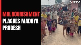 Malnourishment In Madhya Pradesh A Silent Pandemic [upl. by Eachern]