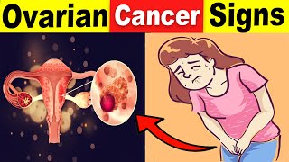 9 Common Ovarian Cancer Signs That You Should Never Ignore [upl. by Kinsman724]