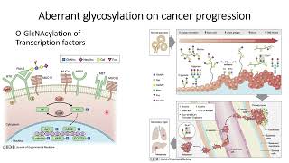 OGlcNAcylation and Aberrant glycosylation in pancreatic cancer tumor progression Code 369 [upl. by Mourant723]