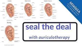 How to Treat Patients with Auriculotherapy for Acupuncturists Chiropractors and More [upl. by Aseel]