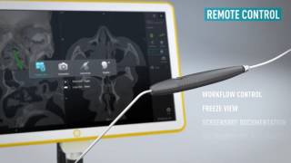 Kick® EM for ENT—Electromagnetic Navigation for Sinus Surgery [upl. by Ecidnac557]