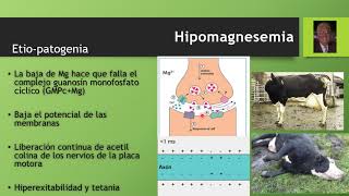 Hipomagnesemia o Tetania de los Pastos Parte 2 [upl. by Renruojos670]