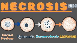 “Nuclear Metamorphosis Exploring Pyknosis Karyorrhexis and Karyolysis” Necrosis part 2 [upl. by Stefan]