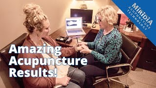 Top Five Tips for AMAZING Acupuncture Results [upl. by Tirreg]