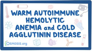 Warm autoimmune hemolytic anemia and cold agglutinin NORD [upl. by Assen]