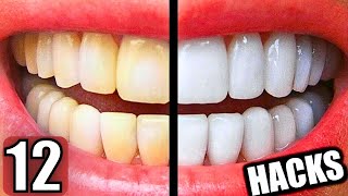 12 Easy Ways to Make Your Teeth Whiter at Home [upl. by Ecirtemed]