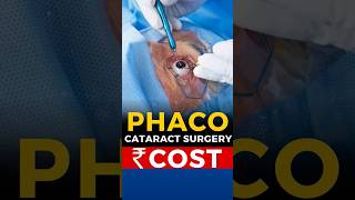 Phaco Cataract Surgery Cost [upl. by Gerianna]