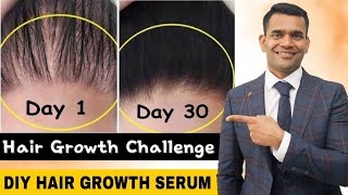 HOW TO ADD HAIR VOLUME  HAIR VOLUME TIPS FOR MEN  Mens Hair [upl. by Piper]