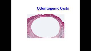 Odontogenic Cysts [upl. by Tally]