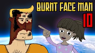 Burnt Face Man Episode 10 [upl. by Soirtimid726]