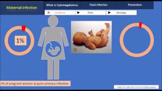 cytomegalovirus cytomegalovirus microbiology cytomegalovirus igg positive in pregnancy [upl. by Berglund]