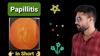 Optic Neuritis Papillitis lecture [upl. by Winchester]