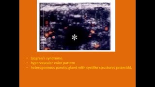 SALIVARY GLAND ULTRASOUND [upl. by Aitam856]