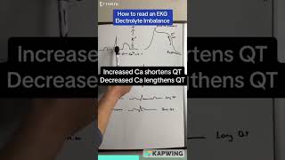 Electrolyte imbalance in ECG [upl. by Ecinahc]