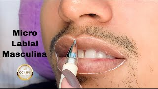 MICRO LABIAL MASCULINA [upl. by Sadnac865]