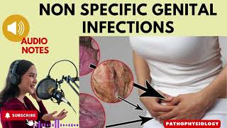 NonSpecific Genital Infections Causes Symptoms and Treatment Audio Notes [upl. by Etteuqram]