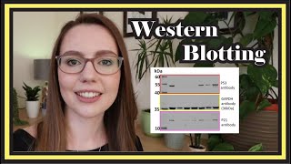 Western Blotting  Principle and Procedure  western blotting technique step by step [upl. by Eisac]