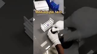 Reticulocyte count 🧑‍🔬🔬 medical lab Reticulocytecount youtubeshorts mbbs shortsmedicallabtech [upl. by Lemyt101]