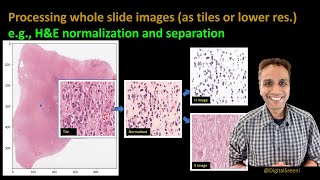 267  Processing whole slide images as tiles [upl. by Ajnotal670]