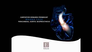 CarpentierEdwards PERIMOUNT Magna Ease aortic valve [upl. by Aldos849]