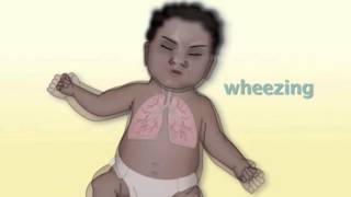 Common Pediatric Respiratory Problems by M Kleinman  OPENPediatrics [upl. by Ynolem]