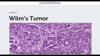 Wilms Tumor [upl. by Yrocaj]