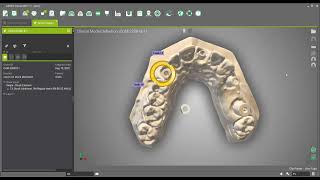 Create a full implant crown with a screw channel on a stock abutment [upl. by Aneryc961]