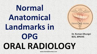 How to look and interpret Orthopantomogram [upl. by Orsino]