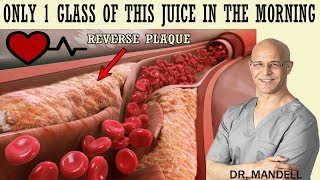 1 GLASS OF THIS JUICE IN THE MORNINGREVERSE CLOGGED ARTERIES amp LOWER HIGH BLOOD PRESSURE [upl. by Ahsinod]