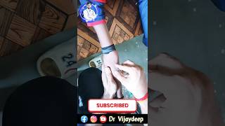 Iv injection kaise lagaye नश का सुई कैसे लगाएं सबसे आसान तरीका medical injectionfunny injection [upl. by Akenal994]