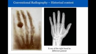 Introduction to Radiology Conventional Radiography [upl. by Jazmin]