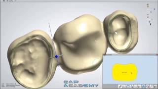 How to Design Bridge Connectors and Anatomical Copings with 3Shape Dental System [upl. by Mascia]