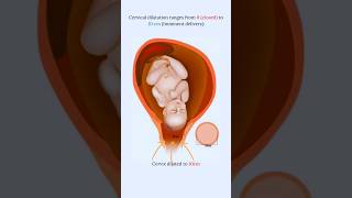 Effacement and Dilatation 🤔fetus share foryou [upl. by Lampert]