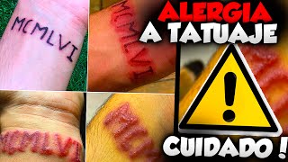 TATUAJE SALE MAL REACCIÓN ALÉRGICA [upl. by Adnimra756]