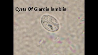 Cysts of Giardia lamblia in a saline wet mount labmedicine9265Parasitology [upl. by Ceporah994]