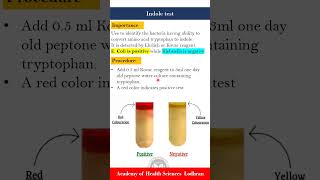 Indole test  Microbiology  by ImranYaseen [upl. by Naicul]