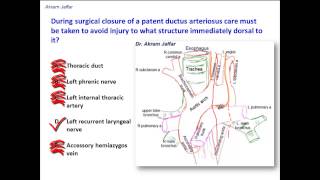 What structure is immediately dorsal to the ligamentum arteriosum [upl. by Winograd]