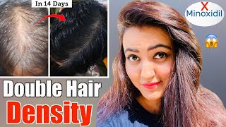 14 Days Challenge  Try This Hair Growth Remedy To Get Double Hair Density amp Thick Long Hair❤️ [upl. by Esorbma]