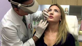 Juvederm Lip Filler  Total Dermatology [upl. by Nadual]