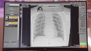 CARESTREAM Image Suite Software with DRXDetector Xray Imaging [upl. by Evante]