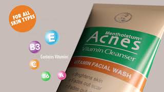 ACNES VITAMIN CLEANSER KENYA [upl. by Sussman]