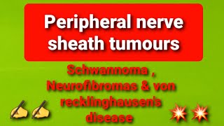 Peripheral nerve sheath tumours [upl. by Lea51]