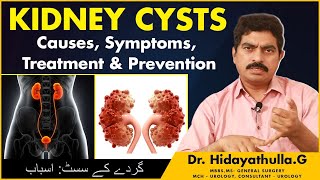 Simple Kidney Cysts  Kidney Cyst Symptoms  Renal Cyst Treatment  Dr Hidayatullah  TX Hospitals [upl. by Jerrilee715]