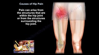 hip pain causes diagnosis and treatment [upl. by Anirtep9]