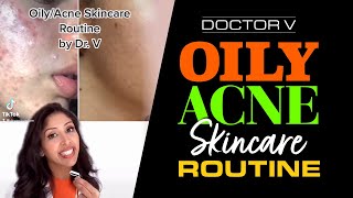 Doctor V  Oily Acne Skincare Routine  Skin Of Colour  Brown Or Black Skin  shorts [upl. by Rednasela]