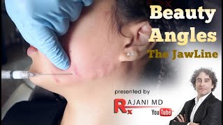 How to Create Beauty Angles  Filler Injections Jawline Rajawline Portland Oregon [upl. by Nagud]