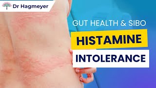 Histamine Intolerance Gut Health amp SIBO Unraveling the Connection Between Your Gut Histamine [upl. by Oine]